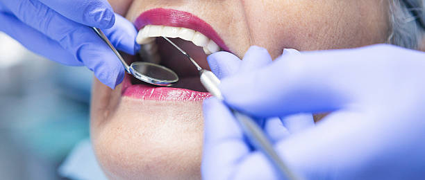 Best Emergency Broken Tooth Repair in Oswego, NY